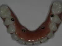 Konig Center for Cosmetic & Comprehensive Dentistry smile photos